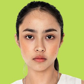 Combination - Saniderm
